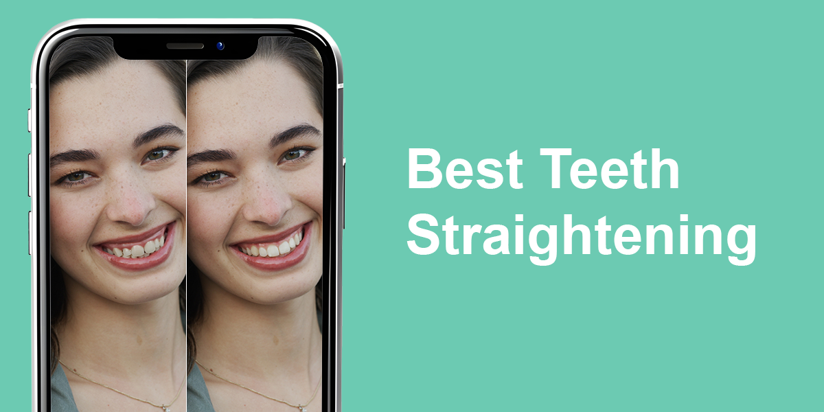 best teeth straightening app