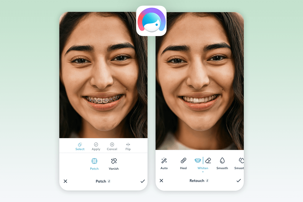 facetune no braces filter