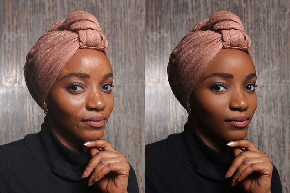 correct image Services List Skin defect removal