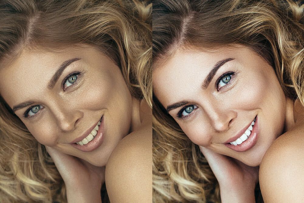 post processing photography Services Teeth whitening