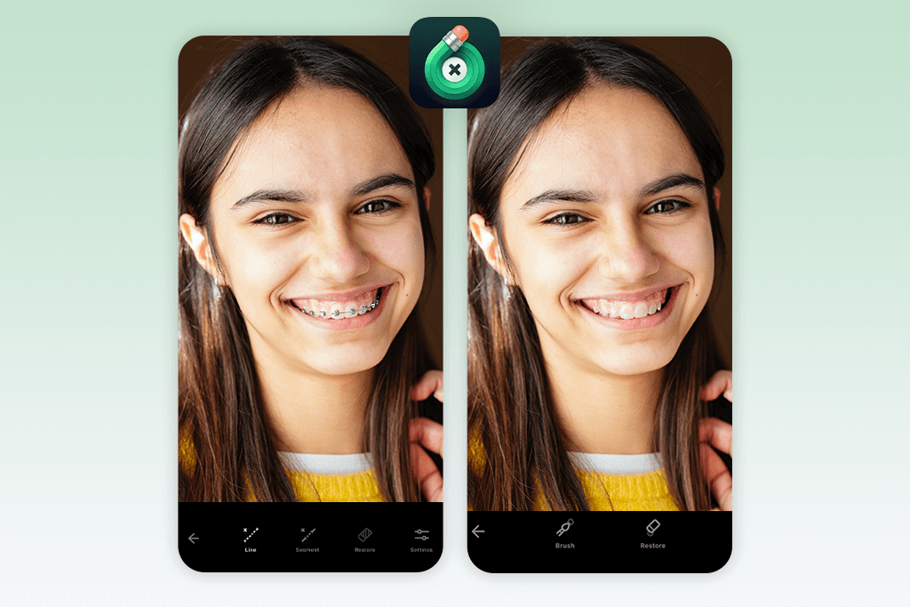 touchretouch no braces filter