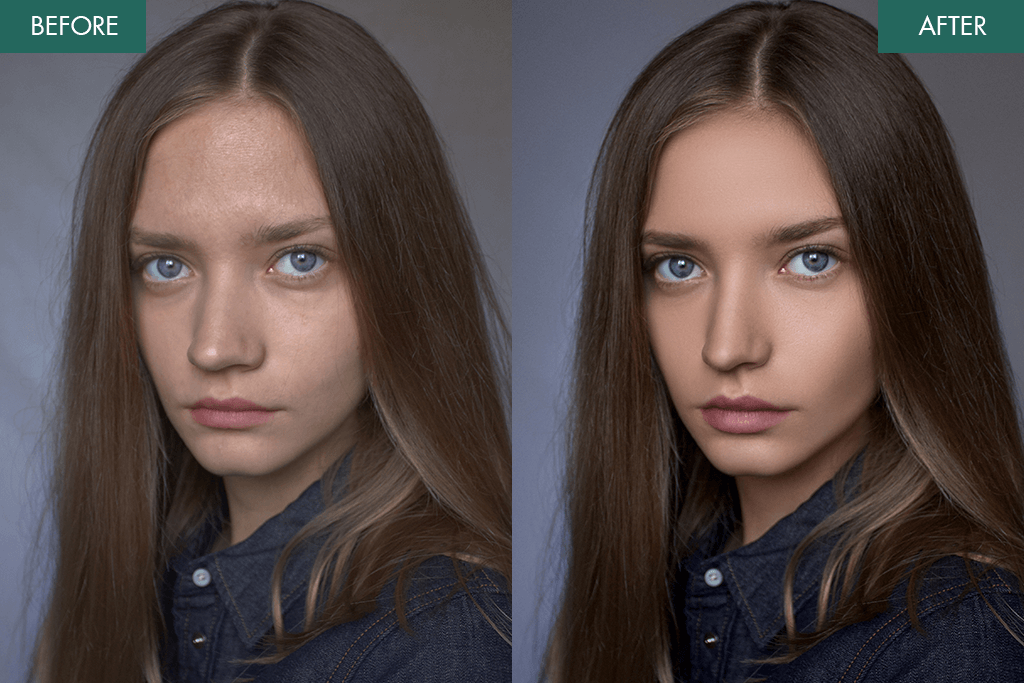 weedit forehead shrinking before and after