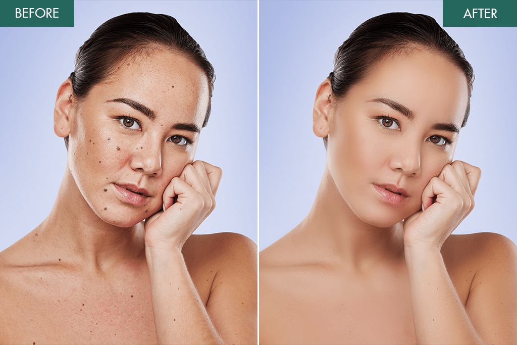 weedit photos portrait retouching services